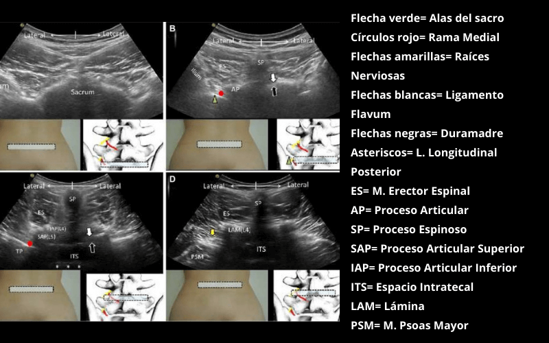 Nervios Dorsales Lumbares 1 (1).png